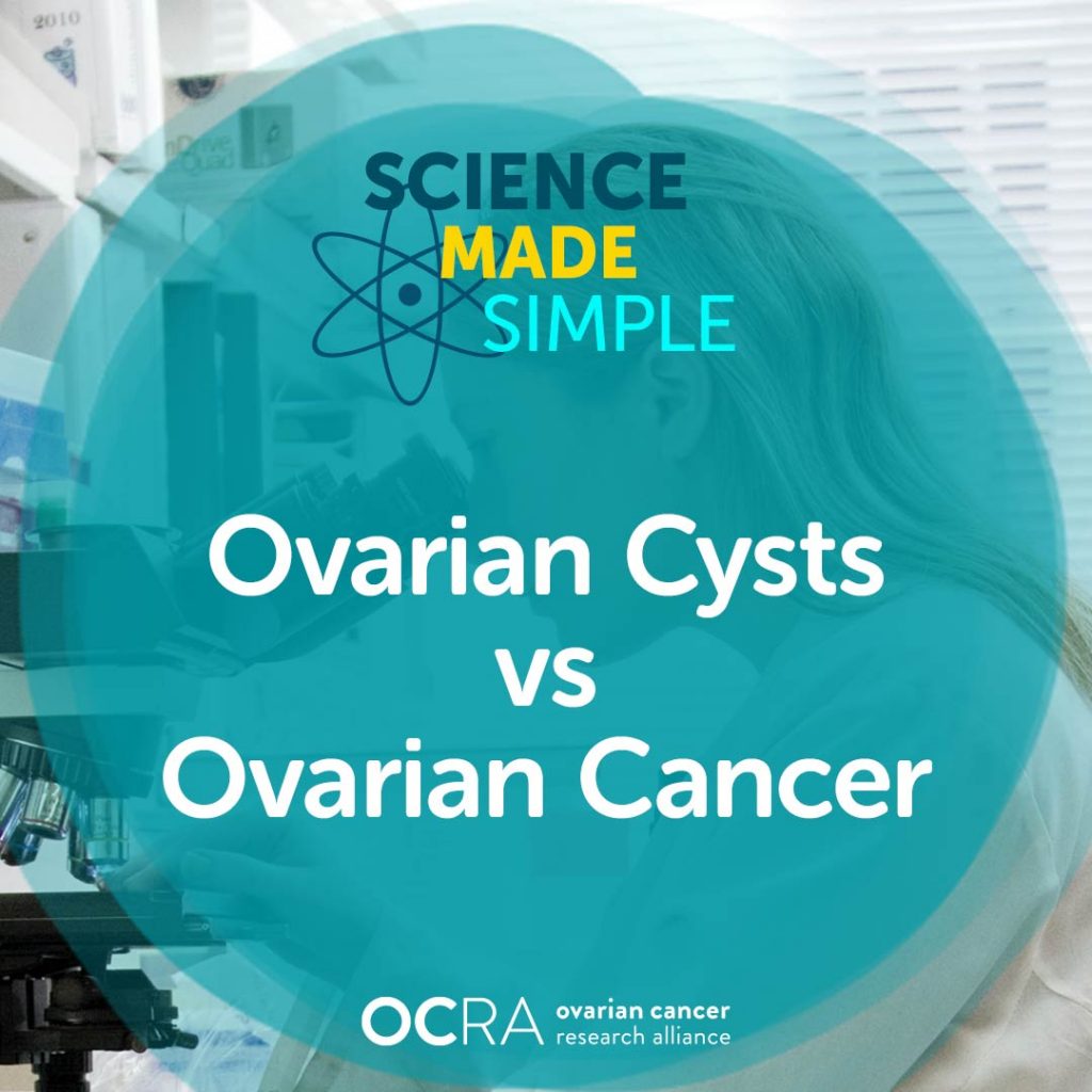 graphic reading, ovarian cysts vs ovarian cancer