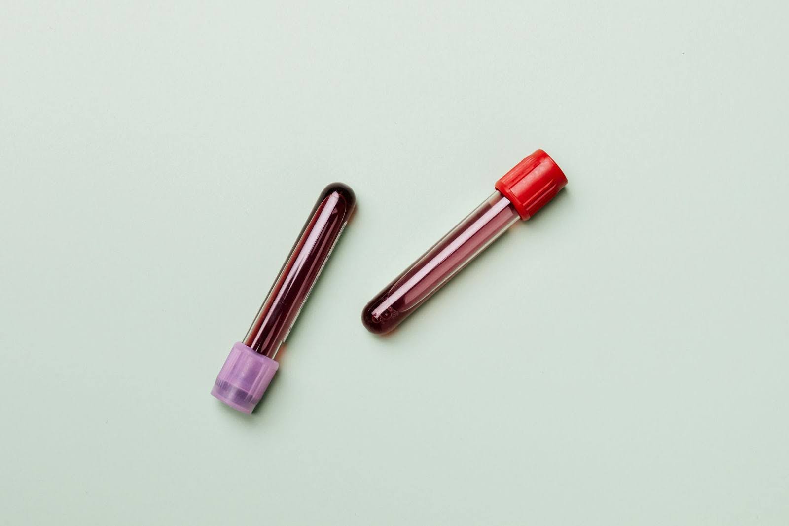 CA-125 Blood test