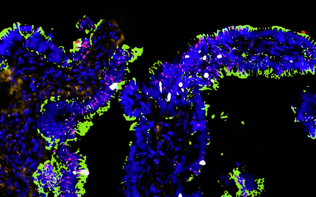 Close up of scientific image in Discovery Lab of Community Accelerated Research Exchange